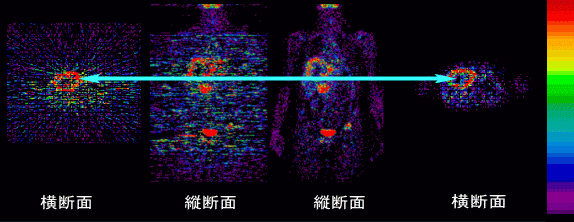 手法の比較