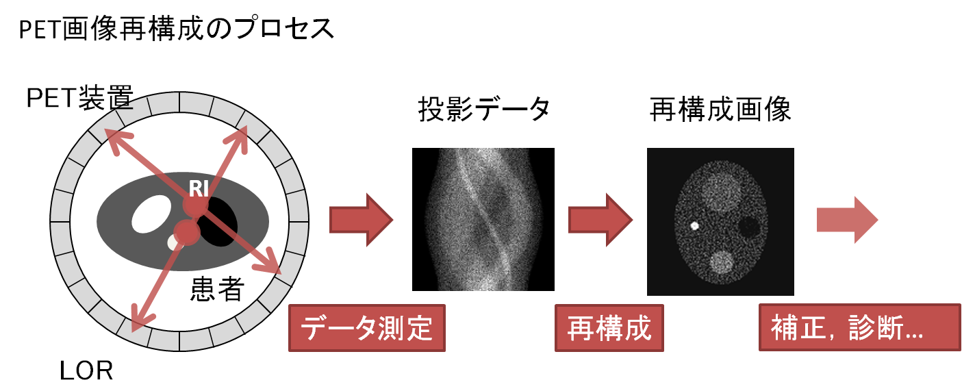 PET画像再構成のプロセス